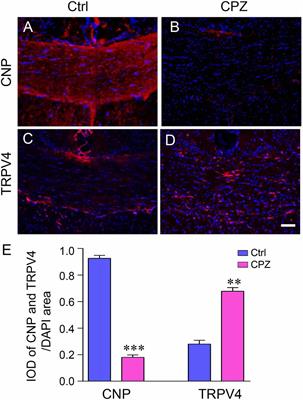 TRPV4 Inhibition Improved Myelination and Reduced Glia Reactivity and Inflammation in a Cuprizone-Induced Mouse Model of Demyelination